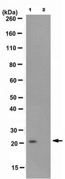 Anti-monoubiquityl Histone H2B (Lys119) Antibody, clone 7B4 clone 7B4, from mouse