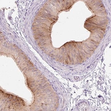 Anti-VPS25 antibody produced in rabbit Prestige Antibodies&#174; Powered by Atlas Antibodies, affinity isolated antibody, buffered aqueous glycerol solution