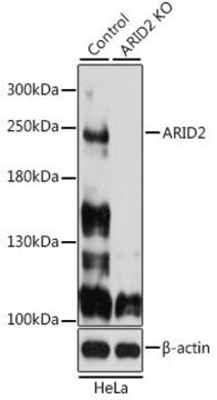 Anti-ARID2 antibody produced in rabbit