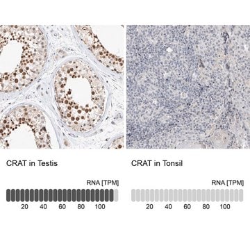 Anti-CRAT antibody produced in rabbit Prestige Antibodies&#174; Powered by Atlas Antibodies, affinity isolated antibody, buffered aqueous glycerol solution, Ab2