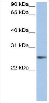 Anti-MyF5 antibody produced in rabbit affinity isolated antibody