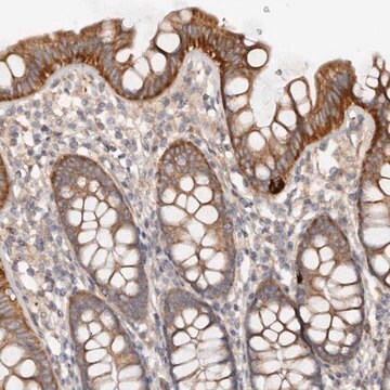 Anti-DMRT2 antibody produced in rabbit Prestige Antibodies&#174; Powered by Atlas Antibodies, affinity isolated antibody, buffered aqueous glycerol solution