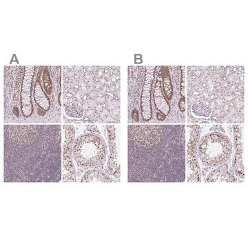 Anti-PTPN2 antibody produced in rabbit Prestige Antibodies&#174; Powered by Atlas Antibodies, affinity isolated antibody, buffered aqueous glycerol solution