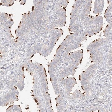 Anti-TRANK1 antibody produced in rabbit Prestige Antibodies&#174; Powered by Atlas Antibodies, affinity isolated antibody, buffered aqueous glycerol solution