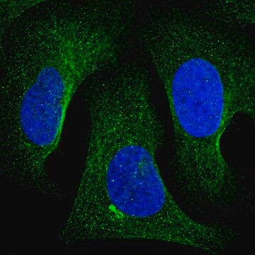 Anti-TNKS2 antibody produced in rabbit Prestige Antibodies&#174; Powered by Atlas Antibodies, affinity isolated antibody, buffered aqueous glycerol solution