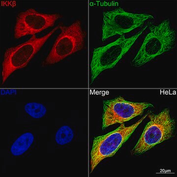 Anti-IKK&#946; Antibody, clone 8X6V3, Rabbit Monoclonal