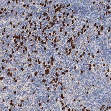 Anti-OTOA antibody produced in rabbit Prestige Antibodies&#174; Powered by Atlas Antibodies, affinity isolated antibody, buffered aqueous glycerol solution