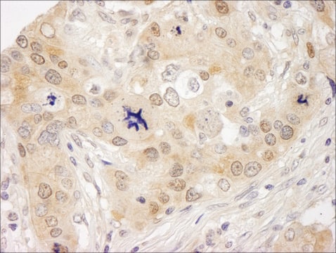 Rabbit anti-Lasu1/Ureb1 Antibody, Affinity Purified Powered by Bethyl Laboratories, Inc.