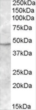 Anti-TMPRSS4 antibody produced in goat affinity isolated antibody, buffered aqueous solution