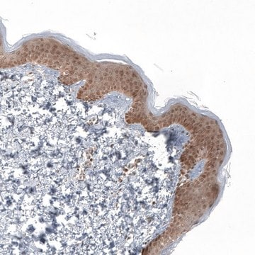 Anti-KLHL24 antibody produced in rabbit Prestige Antibodies&#174; Powered by Atlas Antibodies, affinity isolated antibody, buffered aqueous glycerol solution