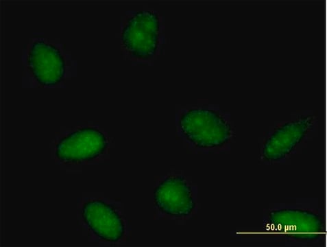 Anti-PTS antibody produced in mouse purified immunoglobulin, buffered aqueous solution