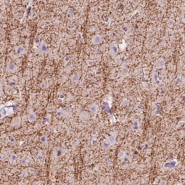 Anti-SIRT2 antibody produced in rabbit Prestige Antibodies&#174; Powered by Atlas Antibodies, affinity isolated antibody, buffered aqueous glycerol solution