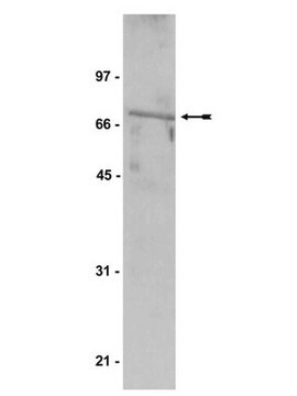 Anti-TBX2 Antibody serum, Upstate&#174;