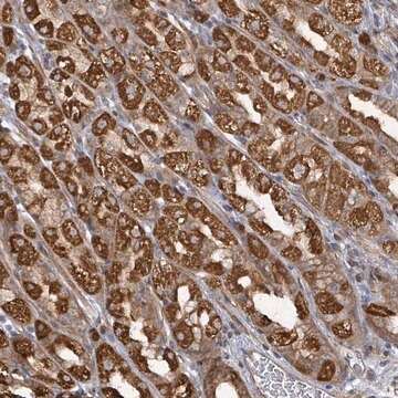 Anti-KBTBD11 antibody produced in rabbit Prestige Antibodies&#174; Powered by Atlas Antibodies, affinity isolated antibody, buffered aqueous glycerol solution