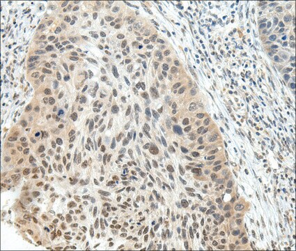 Anti-NSD1 affinity isolated antibody