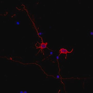 Neuro-Chrom Pan Neuronal Marker Antibody-Rabbit Neuro-Chrom, from rabbit