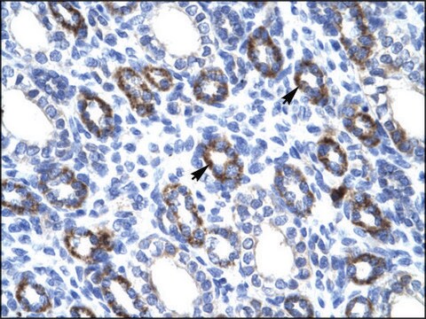 Anti-RGS6 antibody produced in rabbit affinity isolated antibody