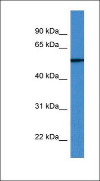 Anti-TUBB6 antibody produced in rabbit affinity isolated antibody