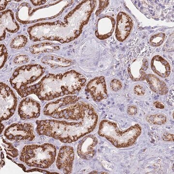 Anti-TTLL1 antibody produced in rabbit Prestige Antibodies&#174; Powered by Atlas Antibodies, affinity isolated antibody, buffered aqueous glycerol solution