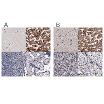 Anti-DECR1 antibody produced in rabbit Prestige Antibodies&#174; Powered by Atlas Antibodies, affinity isolated antibody, buffered aqueous glycerol solution, Ab1