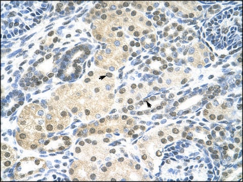 Anti-SMARCE1 antibody produced in rabbit affinity isolated antibody