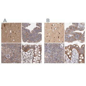 Anti-TSPOAP1 antibody produced in rabbit Prestige Antibodies&#174; Powered by Atlas Antibodies, affinity isolated antibody, buffered aqueous glycerol solution, Ab2