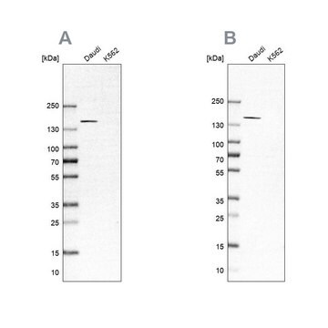 Anti-PLCG2 antibody produced in rabbit Prestige Antibodies&#174; Powered by Atlas Antibodies, affinity isolated antibody, buffered aqueous glycerol solution, Ab1