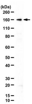 Anti-Kinesin-like protein KIF7 from rabbit, purified by affinity chromatography