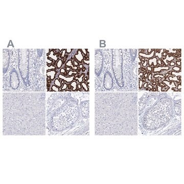 Anti-CSN3 antibody produced in rabbit Prestige Antibodies&#174; Powered by Atlas Antibodies, affinity isolated antibody, buffered aqueous glycerol solution