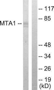 Anti-MTA1 antibody produced in rabbit affinity isolated antibody