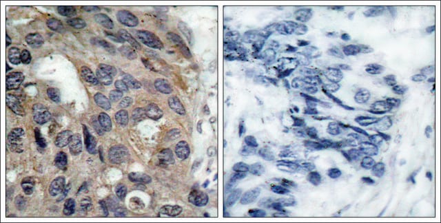 Anti-phospho-SRC (pTyr529) antibody produced in rabbit affinity isolated antibody