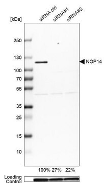 Anti-NOP14 antibody produced in rabbit Prestige Antibodies&#174; Powered by Atlas Antibodies, affinity isolated antibody, buffered aqueous glycerol solution