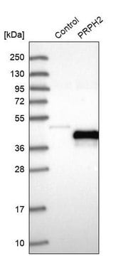 Anti-PRPH2 antibody produced in rabbit Prestige Antibodies&#174; Powered by Atlas Antibodies, affinity isolated antibody, buffered aqueous glycerol solution