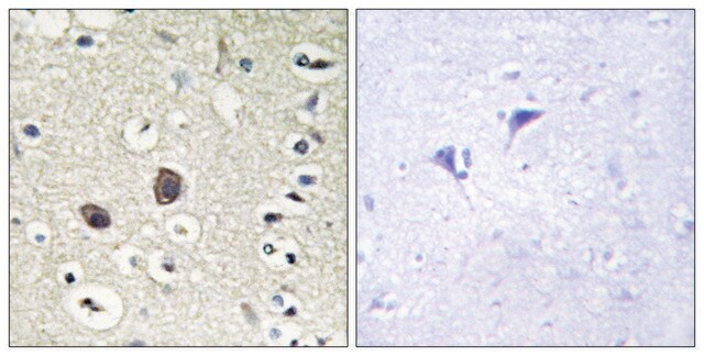 Anti-TIE2, C-Terminal antibody produced in rabbit affinity isolated antibody