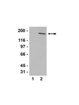 Anti-AS160(Rab-GAP)-Antikörper serum, Upstate&#174;