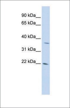 Anti-DDIT4L antibody produced in rabbit affinity isolated antibody