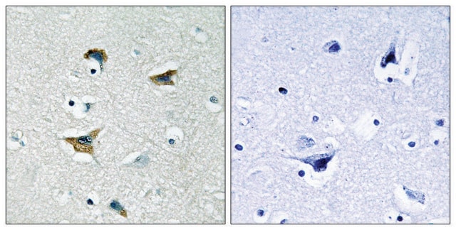 Anti-FAK antibody produced in rabbit affinity isolated antibody