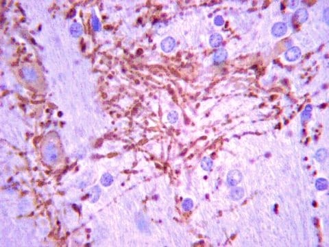 Anti-K+/Cl- Kotransporter (KCC2)-Antikörper, Klon&nbsp;N1/12 clone N1/12, from mouse