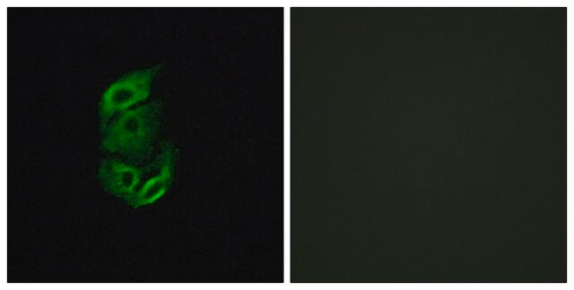 Anti-STA13 antibody produced in rabbit affinity isolated antibody