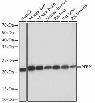 Anti-PEBP1 antibody produced in rabbit