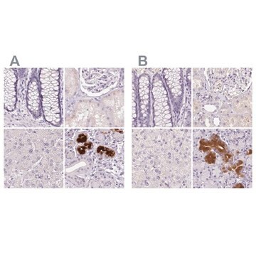 Anti-BPIFB2 antibody produced in rabbit Prestige Antibodies&#174; Powered by Atlas Antibodies, affinity isolated antibody, buffered aqueous glycerol solution