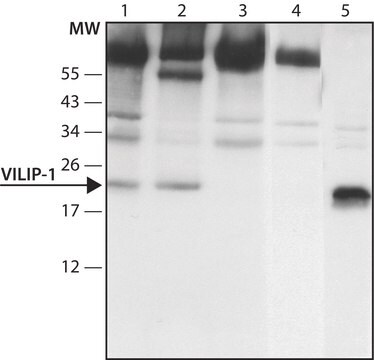 Anti-VILIP-1 (C-terminal) antibody produced in rabbit ~1.5&#160;mg/mL, affinity isolated antibody