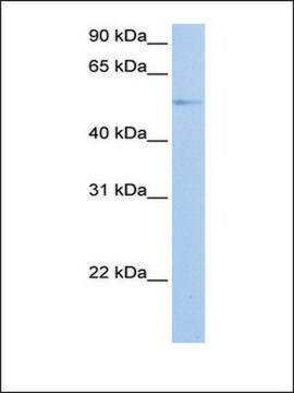 Anti-GRK4 antibody produced in rabbit affinity isolated antibody