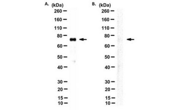 Anti-Nrf2-Antikörper, Klon 103 clone 103, from rat