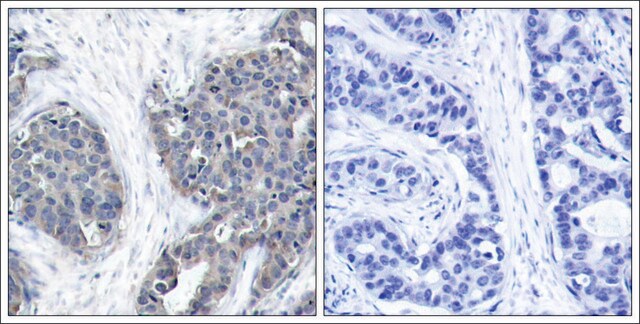 Anti-STMN1 (Ab-38) antibody produced in rabbit affinity isolated antibody