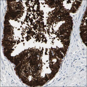 Anti-GREM1 antibody produced in rabbit Prestige Antibodies&#174; Powered by Atlas Antibodies, affinity isolated antibody, buffered aqueous glycerol solution