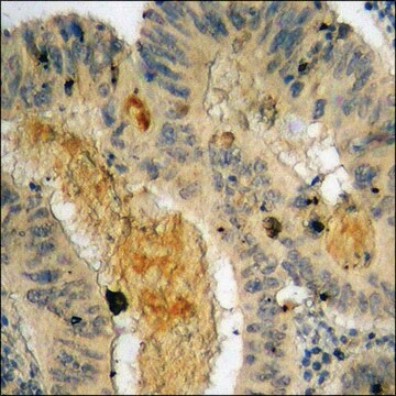 Anti-phospho-IKK-&#946; (pTyr199) antibody produced in rabbit affinity isolated antibody