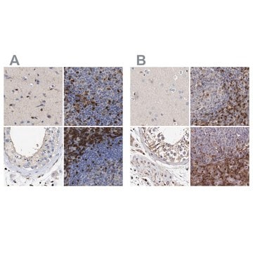 Anti-GIMAP4 antibody produced in rabbit Prestige Antibodies&#174; Powered by Atlas Antibodies, affinity isolated antibody, buffered aqueous glycerol solution, Ab1