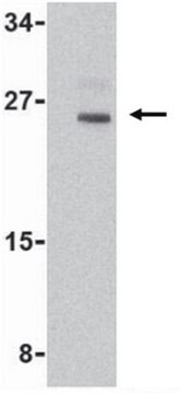 Anti-Nop30 Antibody from rabbit, purified by affinity chromatography