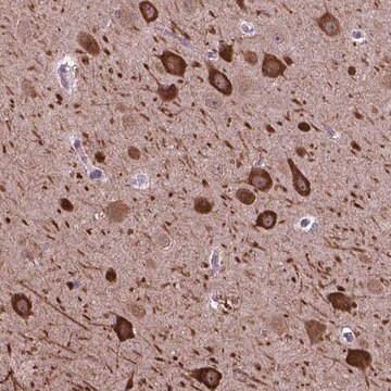 Anti-PIAS3 antibody produced in rabbit Prestige Antibodies&#174; Powered by Atlas Antibodies, affinity isolated antibody, buffered aqueous glycerol solution